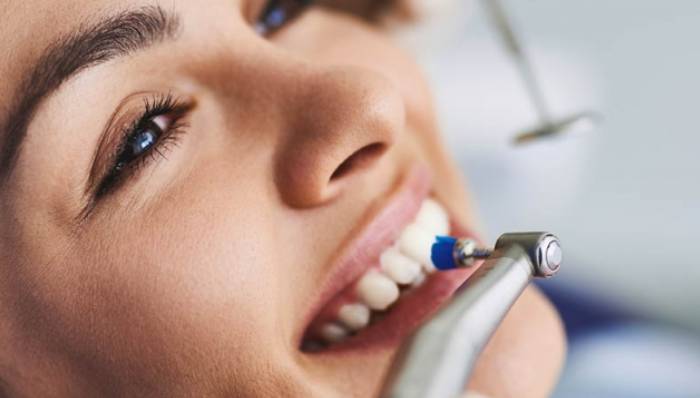 Dental Hygiene