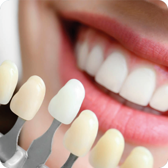 Dental Bonding
