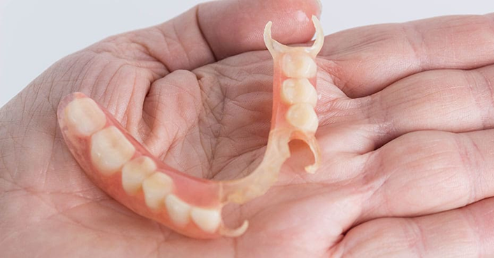 Dentures