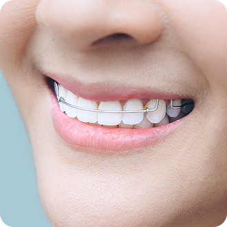 Orthodontic Retainers