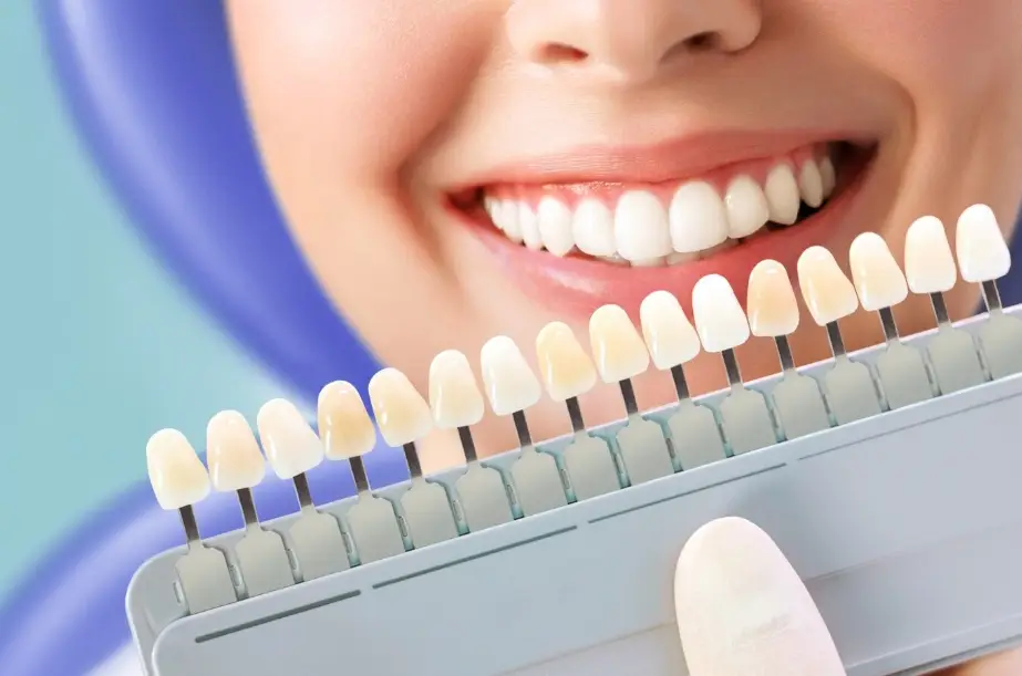Teeth Whitening Services in Arnold