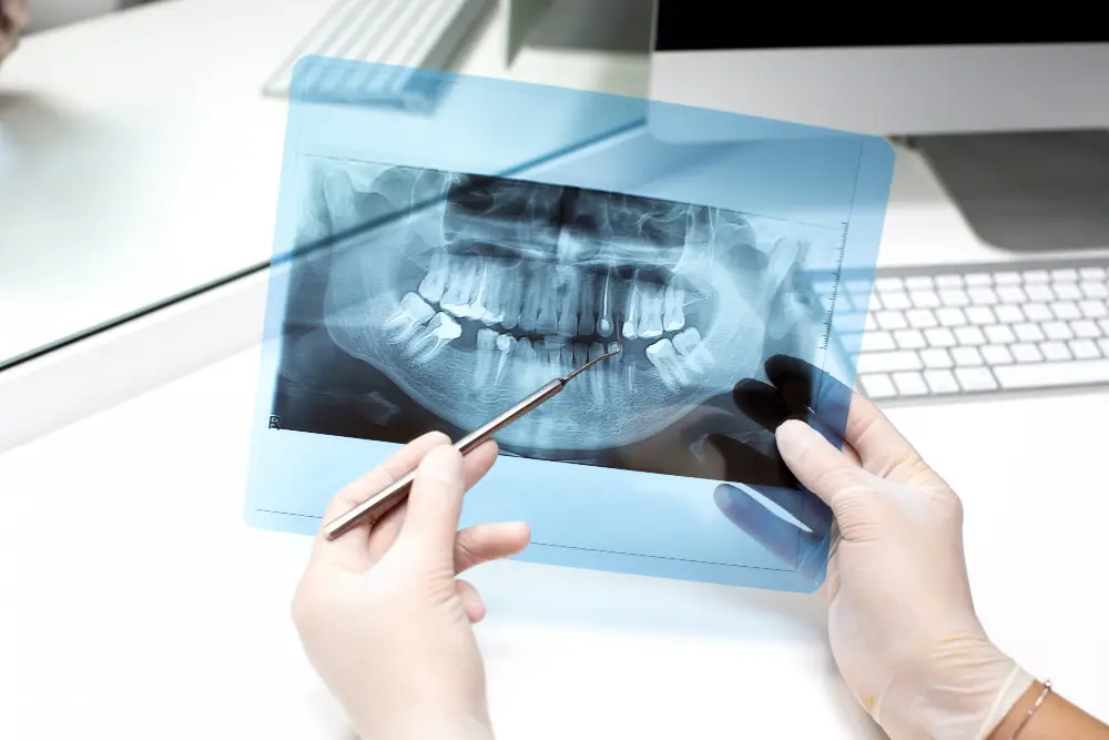 Stop Ignoring Hidden Decay: Why Your Smile Needs Dental X-Rays to See What’s Beneath the Surface.