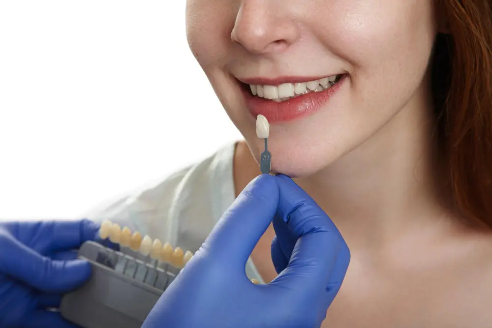 Do Porcelain Veneers Stain