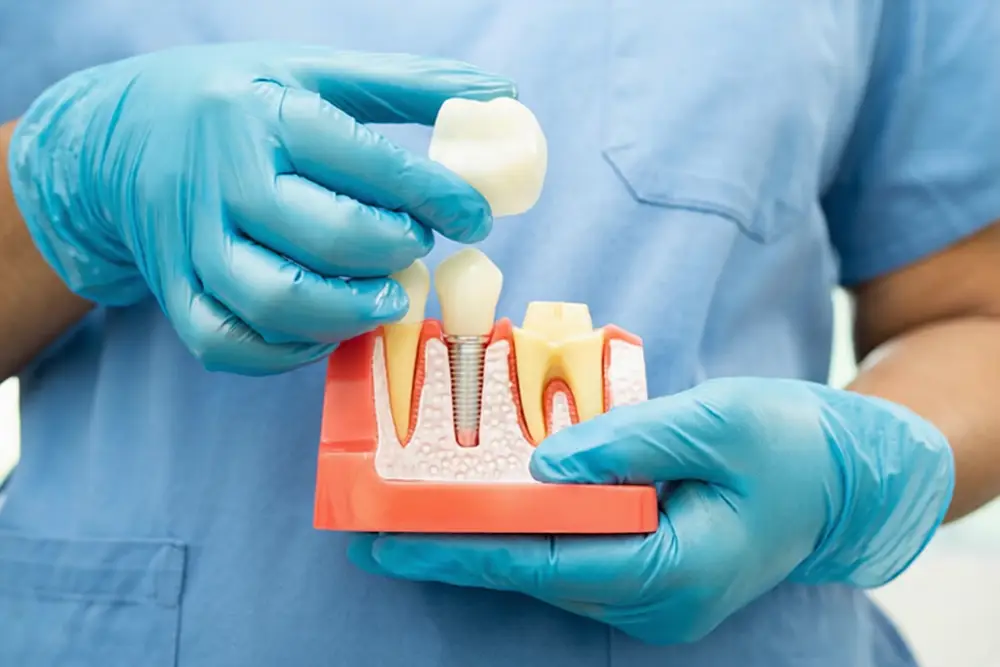 Who is a good candidate for dental implants