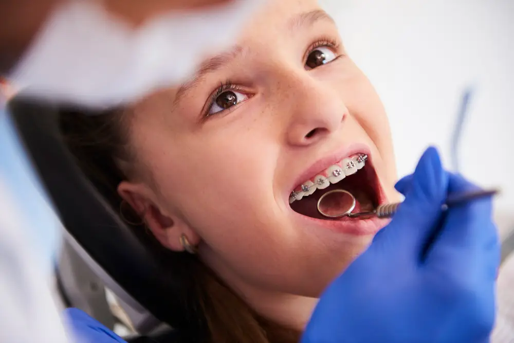 What Can I Eat with Braces