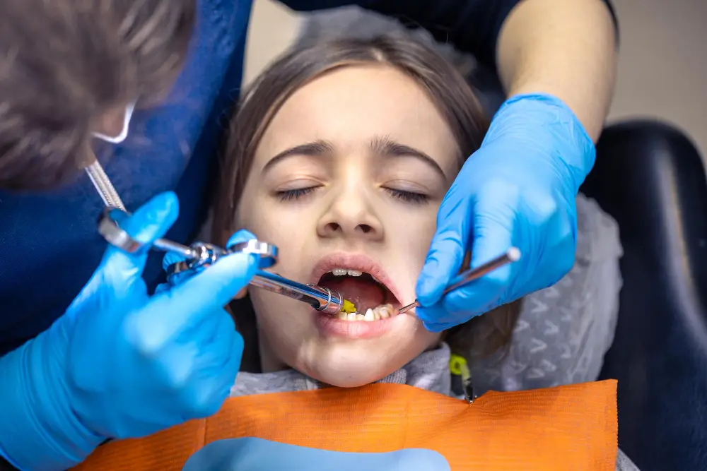 Do cavities in baby teeth need to be filled